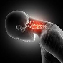Dzemdes kakla osteohondroze